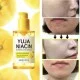 Some By Mi Yuja Niacin 30 Days Blemish Care Serum 50Ml Some By Mi Yuja Niacin 30 Days Blemish Care Serum 50Ml